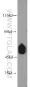 Unc-5 Netrin Receptor C antibody, 20240-1-AP, Proteintech Group, Western Blot image 