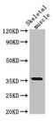 Laforin antibody, LS-C677825, Lifespan Biosciences, Western Blot image 
