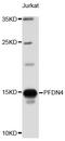 Prefoldin Subunit 4 antibody, STJ26531, St John