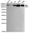 Damage Specific DNA Binding Protein 1 antibody, STJ99189, St John