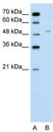 Zinc Finger Protein 19 antibody, TA346445, Origene, Western Blot image 