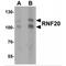 E3 ubiquitin-protein ligase BRE1A antibody, MBS153687, MyBioSource, Western Blot image 