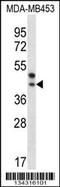 Palmitoyl-Protein Thioesterase 2 antibody, 57-783, ProSci, Western Blot image 