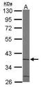 Aminocarboxymuconate Semialdehyde Decarboxylase antibody, TA308027, Origene, Western Blot image 