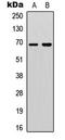Probable ATP-dependent RNA helicase DDX5 antibody, LS-C358965, Lifespan Biosciences, Western Blot image 