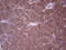 Angiopoietin 2 antibody, M00370, Boster Biological Technology, Immunohistochemistry paraffin image 