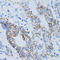 Galectin 8 antibody, LS-C334847, Lifespan Biosciences, Immunohistochemistry paraffin image 