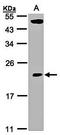 TP53RK Binding Protein antibody, orb69872, Biorbyt, Western Blot image 