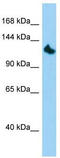 Kinesin Family Member 24 antibody, TA334316, Origene, Western Blot image 