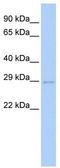 Ubiquitin-conjugating enzyme E2 S antibody, TA329841, Origene, Western Blot image 