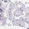 Chromosome 20 Open Reading Frame 85 antibody, NBP2-31709, Novus Biologicals, Immunohistochemistry paraffin image 