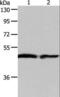 Arylacetamide Deacetylase antibody, LS-C404398, Lifespan Biosciences, Western Blot image 