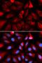 Complement C9 antibody, orb167454, Biorbyt, Immunofluorescence image 