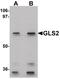 Glutaminase 2 antibody, PA5-21113, Invitrogen Antibodies, Western Blot image 
