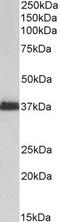 Musashi RNA Binding Protein 2 antibody, TA334180, Origene, Western Blot image 