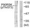 Ribosomal Protein S6 Kinase A1 antibody, TA326168, Origene, Western Blot image 