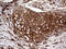 Chloride Channel Accessory 1 antibody, M03318, Boster Biological Technology, Immunohistochemistry paraffin image 