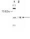 Acetylcholine Receptor antibody, ADI-905-796-100, Enzo Life Sciences, Western Blot image 