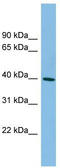 MAGE Family Member B4 antibody, TA337659, Origene, Western Blot image 