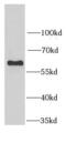 Seryl-TRNA Synthetase antibody, FNab07609, FineTest, Western Blot image 