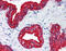 Keratin antibody, 51-357, ProSci, Immunohistochemistry paraffin image 