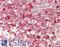 HCLS1 Associated Protein X-1 antibody, LS-B14750, Lifespan Biosciences, Immunohistochemistry paraffin image 