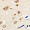 Neuroblastoma breakpoint family member 5 antibody, abx133723, Abbexa, Western Blot image 