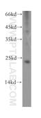 Recoverin antibody, 10073-1-AP, Proteintech Group, Western Blot image 