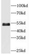 Cyclin-dependent kinase 14 antibody, FNab06344, FineTest, Western Blot image 