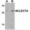 C-Type Lectin Domain Containing 7A antibody, MBS151479, MyBioSource, Western Blot image 