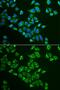 Tachykinin 3 antibody, GTX16441, GeneTex, Immunofluorescence image 