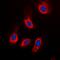 Retinoic Acid Receptor Gamma antibody, orb101688, Biorbyt, Immunofluorescence image 
