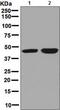 Calcium Binding Protein 1 antibody, GTX64031, GeneTex, Western Blot image 