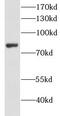 Lumican antibody, FNab04890, FineTest, Western Blot image 