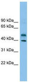 Zinc Finger Protein 784 antibody, TA339844, Origene, Western Blot image 