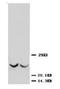 TIMP Metallopeptidase Inhibitor 3 antibody, AP23357PU-N, Origene, Western Blot image 