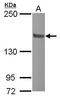 Nuclear Receptor Coactivator 2 antibody, GTX112307, GeneTex, Western Blot image 