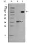 Ret Proto-Oncogene antibody, GTX83058, GeneTex, Western Blot image 