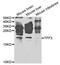 Trefoil Factor 3 antibody, TA332483, Origene, Western Blot image 