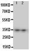 Aquaporin-8 antibody, PA5-78817, Invitrogen Antibodies, Western Blot image 