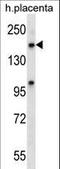 Exportin 5 antibody, LS-C160667, Lifespan Biosciences, Western Blot image 