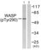 WAS antibody, PA5-38346, Invitrogen Antibodies, Western Blot image 
