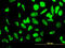Ribosomal Protein S23 antibody, LS-C198129, Lifespan Biosciences, Immunofluorescence image 
