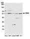 Chromobox 6 antibody, A302-283A, Bethyl Labs, Western Blot image 