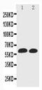 Solute Carrier Family 1 Member 3 antibody, PA2185, Boster Biological Technology, Western Blot image 