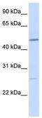 Vitamin D3 receptor antibody, TA335172, Origene, Western Blot image 