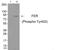 FER Tyrosine Kinase antibody, PA5-37575, Invitrogen Antibodies, Western Blot image 