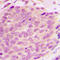 E3 ubiquitin-protein ligase RNF125 antibody, LS-C358283, Lifespan Biosciences, Immunohistochemistry paraffin image 