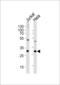 F-actin-capping protein subunit beta antibody, 61-579, ProSci, Western Blot image 