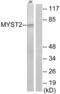 Histone acetyltransferase MYST2 antibody, abx013338, Abbexa, Western Blot image 